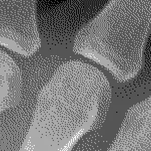 Hand X-Ray